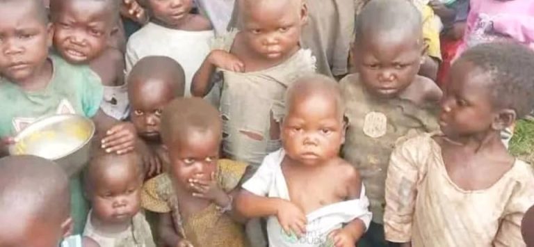 Sud-Kivu : Les centres de santé débordés par la hausse des cas de malnutrition infantile